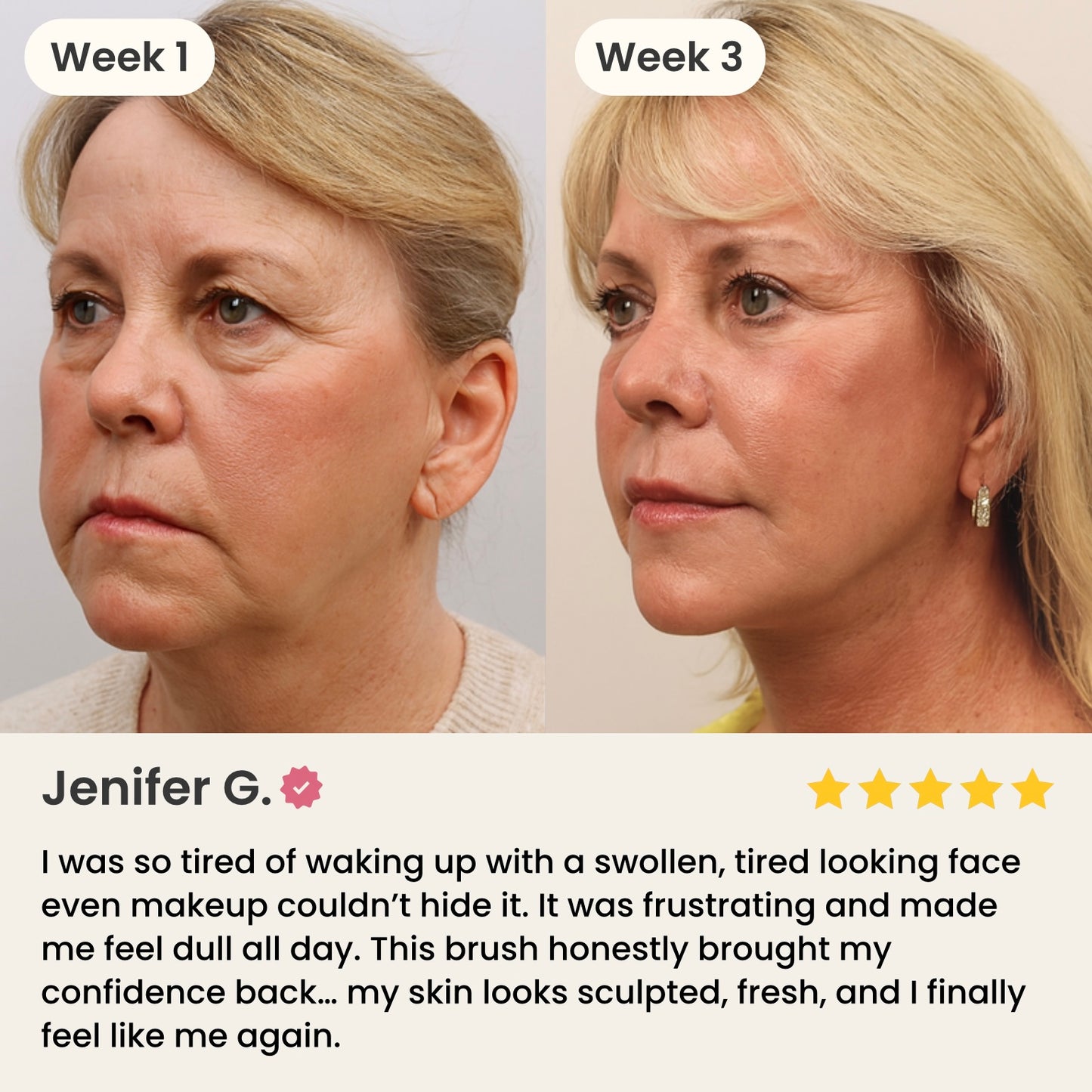 SwirlasLift™ Lymph Face Brush